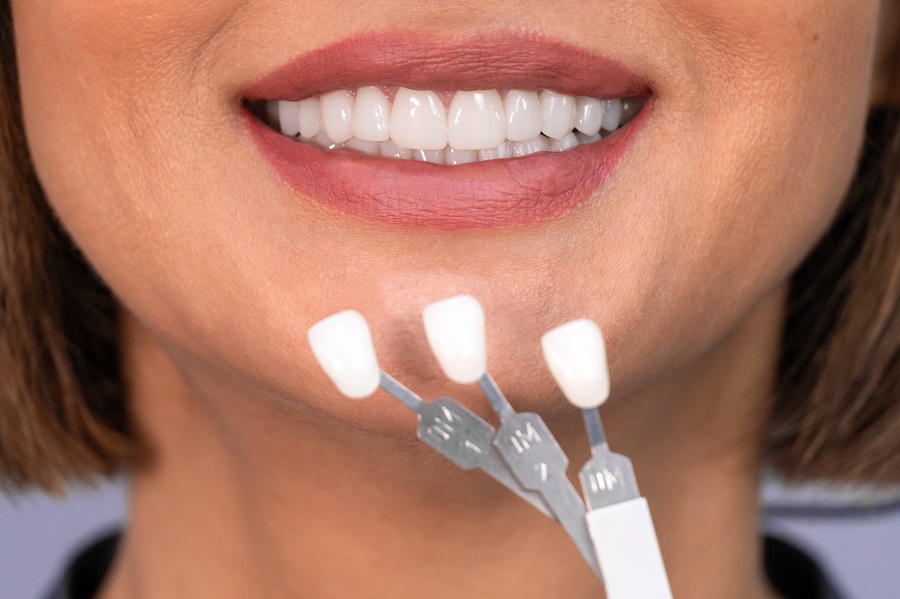 Tampa Dentist: Why Veneers May Be The Right Choice For You